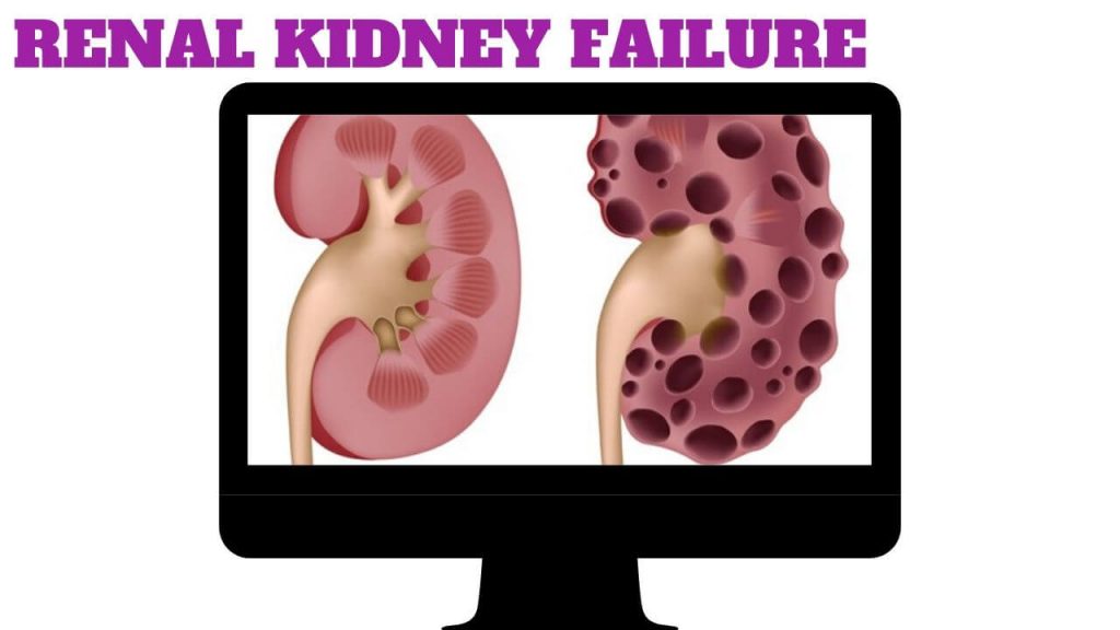 Renal Kidney Failure
